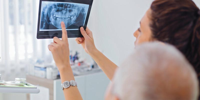 hygienist showing full mouth xray