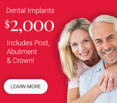 Dental Implants for $2000 All In
